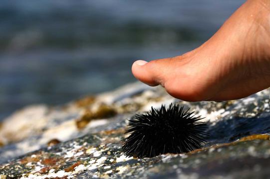 Seeigel – was muss ich beachten?