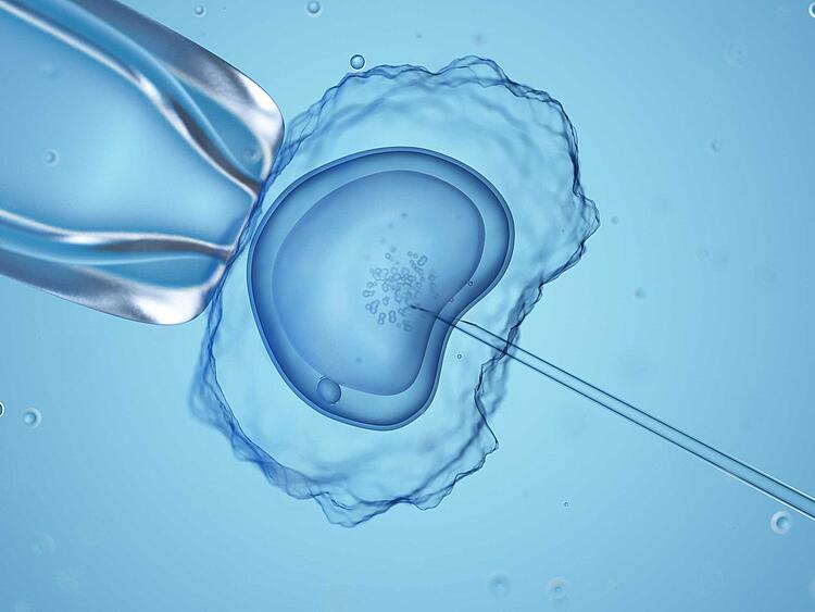 Medizinische Darstellung einer In-vitro-Fertilisation