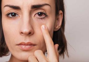 Frau mit mit Bindehautentzündung zieht mit dem Finger ihr Augenlid nach unten